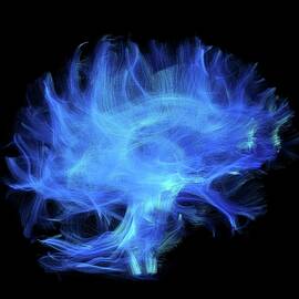 Brain Fibres by Science Photo Library
