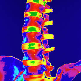 Coloured 3-d Ct Scan Of Lower Spine by Science Photo Library