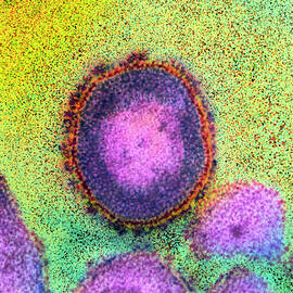 Coloured Tem Of An Hiv Virus by Science Photo Library