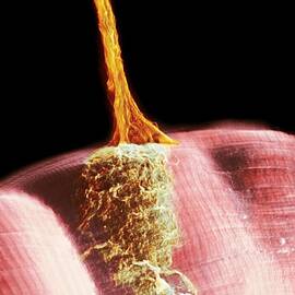 Synapse, SEM by Science Photo Library
