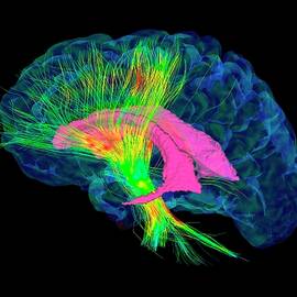 Brain Fibres by Science Photo Library