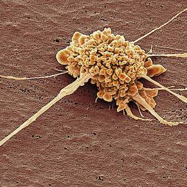 Stem Cell by Science Photo Library