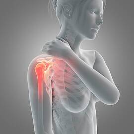 Human Shoulder Pain