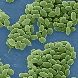 Anthrax Bacteria Sem by Science Source