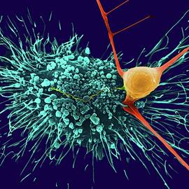 Astrocytic Glial Cell With Cortical Neuron by Science Photo Library
