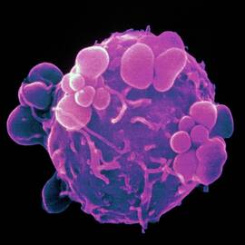 Coloured Sem Of Induced Apoptosis In Cancer Cell by Science Photo Library