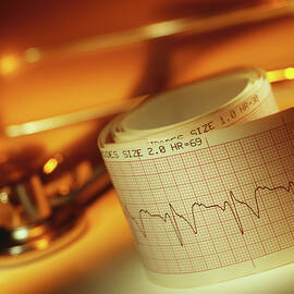 Ecg And Stethoscope by Science Photo Library