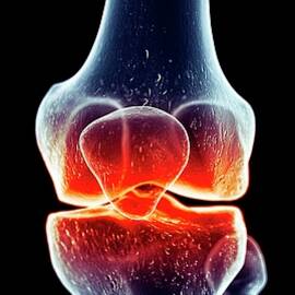 Human Knee Joint Pain