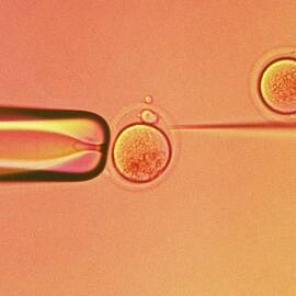 In Vitro Fertilisation by Science Photo Library