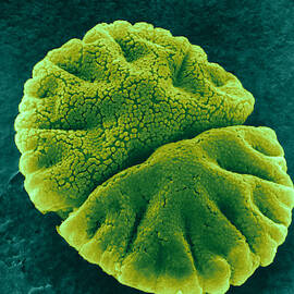 Micrasterias Angulosa, Algae, Sem by Jerome Pickett-Heaps