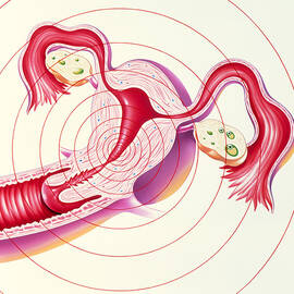 Artwork Of Uterus Suffering Menstrual Pain