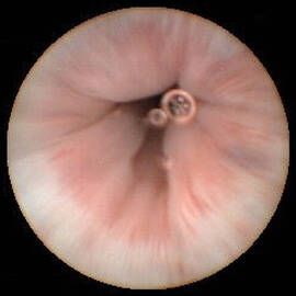 Healthy Oesophagus, Pill Camera View