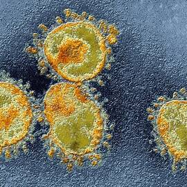 Human Coronavirus, Tem