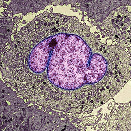 Lung Cancer Cell, Tem