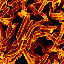 Mycobacterium Tuberculosis Bacteria, Sem by Science Source
