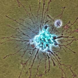 Nerve Cell Growth