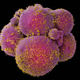 Coloured Sem Of Human Embryo At 8-cell Stage