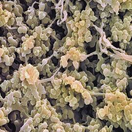 White Blood Cells, Sem