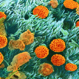 Coloured Sem Of Trachea Surface With Pollen & Dust