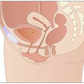 Female Pelvic Anatomy, Artwork