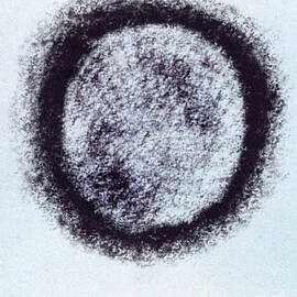 Hantavirus, Tem by Science Source