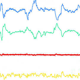 Polygraph Tracings Of Rem Sleep by Omikron