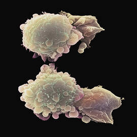 Skin Cancer Cells, Sem