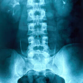 X-ray Of Normal Kidneys by Science Source
