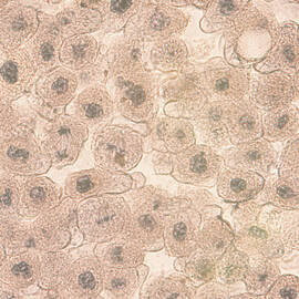 Squamous Epithelial Cells