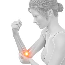 Woman With A Painful Elbow