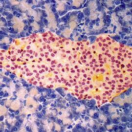 Islet Of Langerhans, Light Micrograph by Steve Gschmeissner