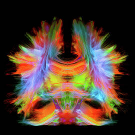 Full Brain Tractography With Artistic Color. This Is A Full Brain Tracking Coming From A Super-resolution Reconstruction Of 0.6 Cubic Mm. Front View. by Sherbrooke Connectivity Imaging Lab (scil)