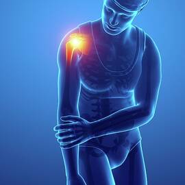Man With Shoulder Pain