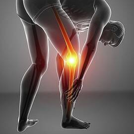 Man With Knee Pain