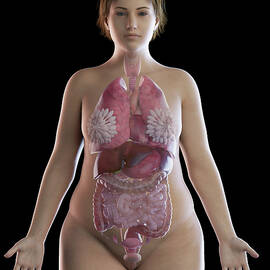 Illustration Of An Obese Woman's Organs