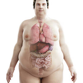 Illustration Of An Obese Man's Organs