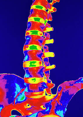 Wall Art - Photograph - Coloured 3-d Ct Scan Of Lower Spine #1 by Science Photo Library