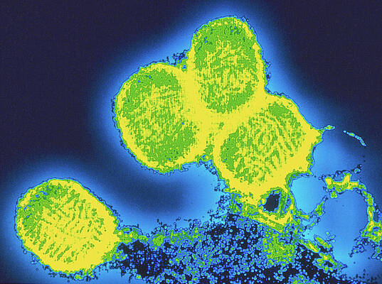 Wall Art - Photograph - Coloured Tem Of Smallpox Variola Viruses #1 by Science Photo Library