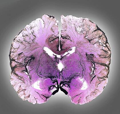 Wall Art - Photograph - Coronal Brain Slice Specimen #1 by Science Photo Library