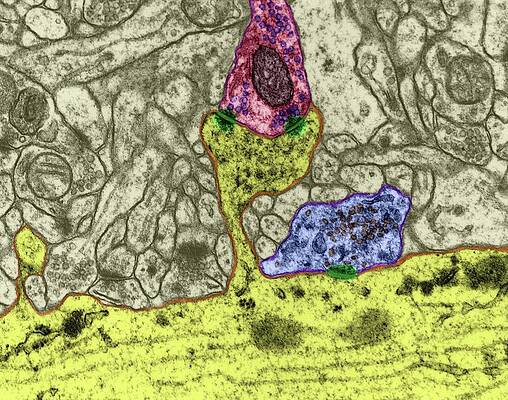 Wall Art - Photograph - Dendritic Spine With Excitatory Synapse #1 by Science Photo Library