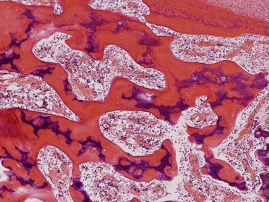 Wall Art - Photograph - Developing Bone, Lm #1 by Science Stock Photography