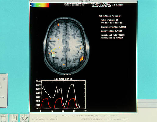 Wall Art - Photograph - Eeg Of Brain Activity During Mathematical Thought #1 by Science Photo Library
