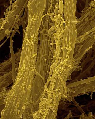 Wall Art - Photograph - Filamentous Iron Oxidizing Bacterium #1 by Science Photo Library