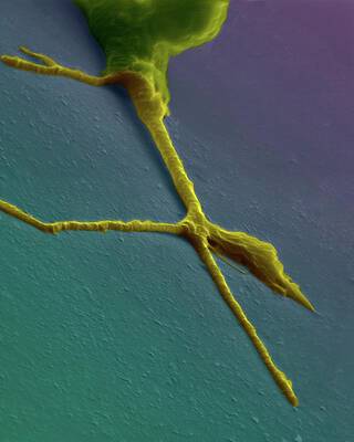 Wall Art - Photograph - Growth Cone From A Developing Neuron #1 by Science Photo Library