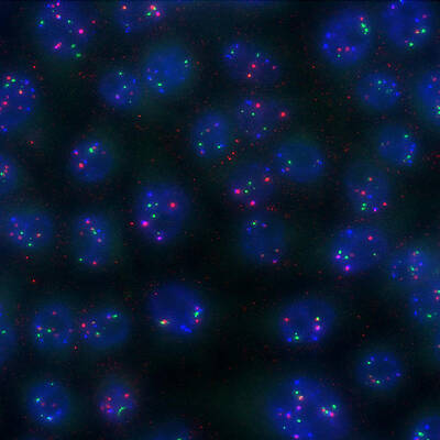 Wall Art - Photograph - Hela Cells, Hipmap #1 by Science Source