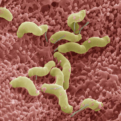 Wall Art - Photograph - Helicobacter Pylori #1 by Eye of Science