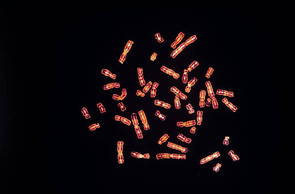 Wall Art - Photograph - Kleinfelter Syndrome Karyotype #1 by Science Photo Library