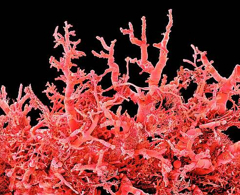 Wall Art - Photograph - Lung Blood Vessels #1 by Science Photo Library