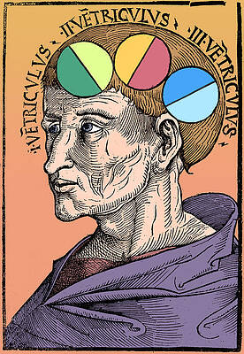 Wall Art - Photograph - Man With Brain Ventricles, Albertus #1 by Science Source