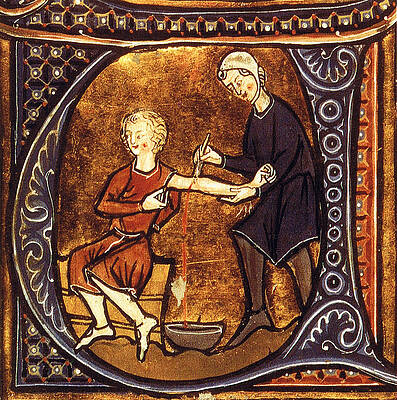 Wall Art - Photograph - Medieval Bloodletting #1 by Science Source